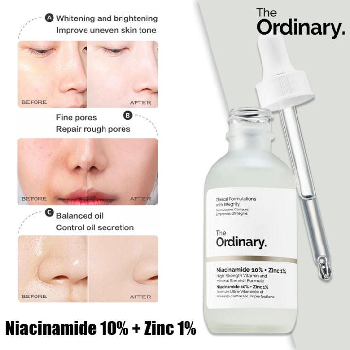 The Ordinary Niacinamide 10% + Zinc 1% Serum (30ml) – Oil Control & Blemish Care